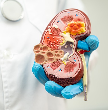 Glomerular Complications