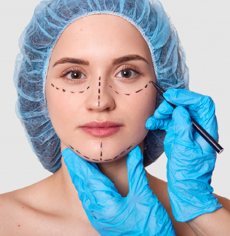 Rhinoplasty Surgery