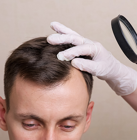 FUE Hair Transplant