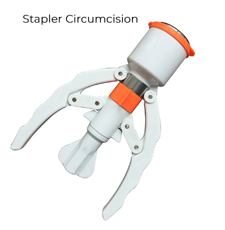 Stapler Circumcision